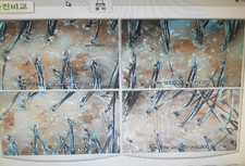 염색후 착색 - 스케일링, 보습관리까지 !