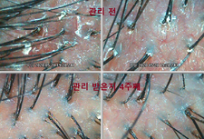 셀톡스케어 4주차