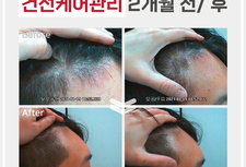 안티에이징 케어 2개월 전/ 후