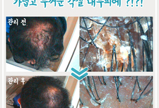 안티에이징케어  5개월 