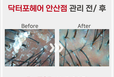 20대여성 컨트롤케어 관리 전/후