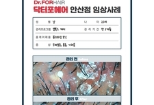 셀톡스케어 20대 남성 3개월 관리 전/후