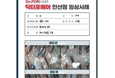 셀톡스케어 3개월 관리 전/후